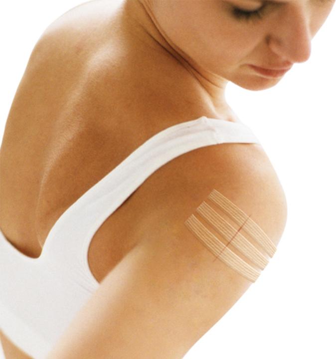 Actual product image 3M Nexcare Steri-Strips wound closure strips (8 x)