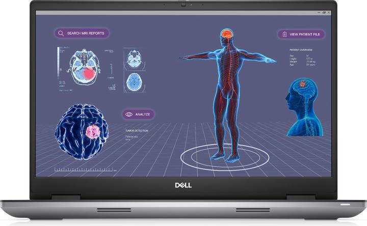 Actual product image Dell Precision 7780 (17.30", Intel Core i7-13850HX, 32 GB, 1000 GB, DE)