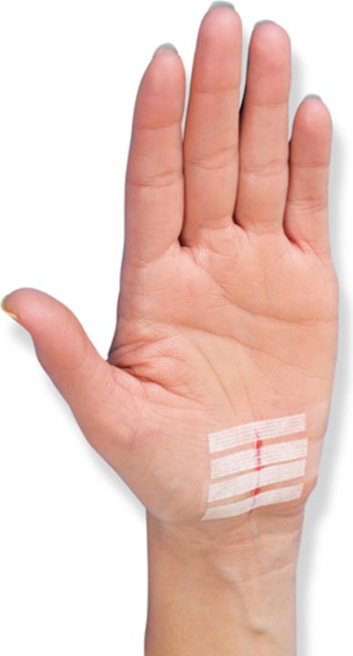 Actual product image 3M Nexcare Steri-Strips wound closure strips (8 x)