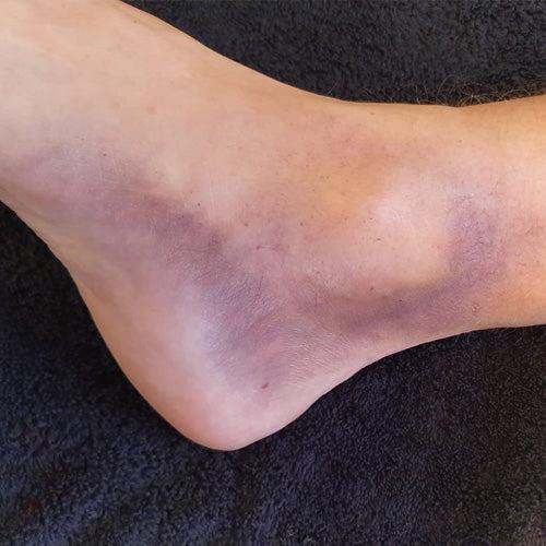 Produktbild Grimas Crème-Makeup 6er-Palette Bruise/Prellungen