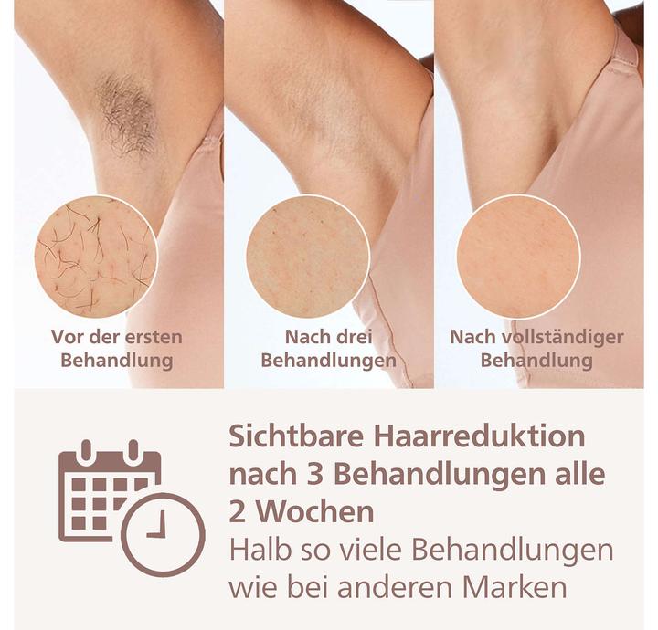 Immagine prodotto Philips Lumea IPL Series 9000