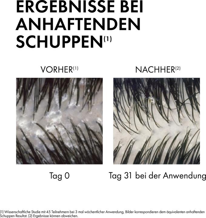 Immagine prodotto Vichy Dercos Anti-Schuppen Shampoo für normale bis fettige Kopfhaut (500 ml, Shampoo liquido)