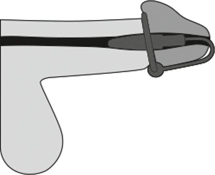 Productafbeelding You2Toys Glansring Dilator