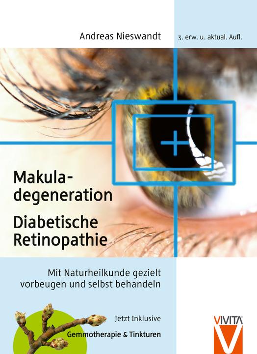 Actual product image Makula-Degeneration und Diabetische Retinopathie (German, Andreas Nieswandt, 2024)