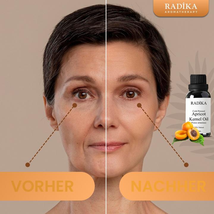 Actual product image Radika Apricot kernel oil, cold-pressed, 100% pure, organic, natural, 30 ml (Body oil, 30 ml)