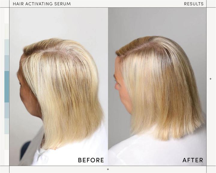 Actual product image M2 Beauté Hair Activating Serum (120 ml)