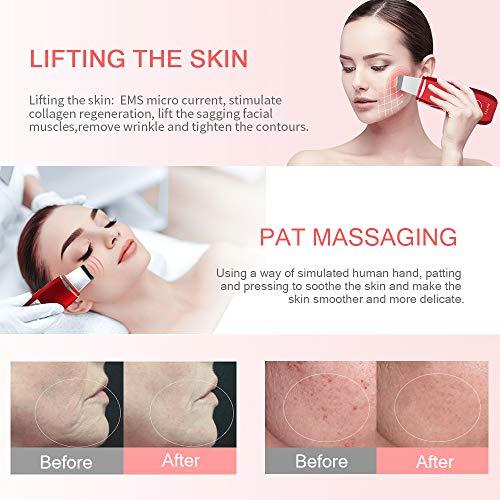 Produktbild Anlan Ultraschallpeelinggerät
