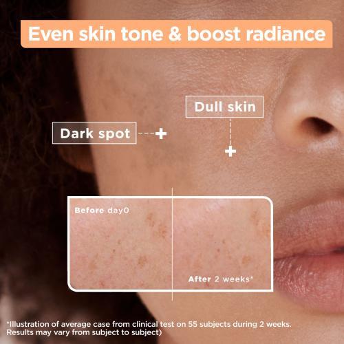 Produktbild Mixa Vitamin C + Glycolic Acid Anti-Dark Spot Serum (30 ml)