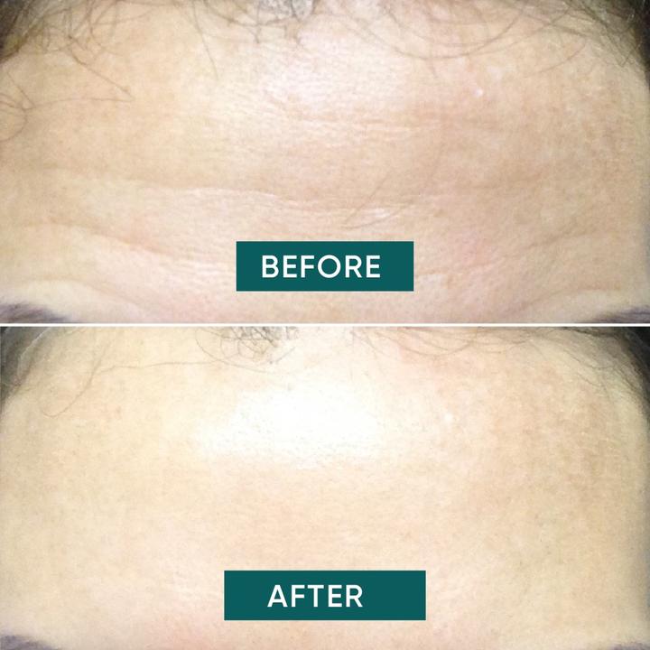 Image du produit Apricot Pad anti-âge