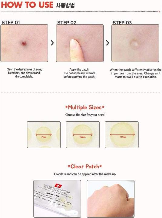 Productafbeelding Cosrx Acne Pimple Master