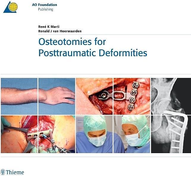 Immagine prodotto Osteotomie per le deformità post-traumatiche (René K. Marti, Ronald J. van Heerwaarden, 2008)