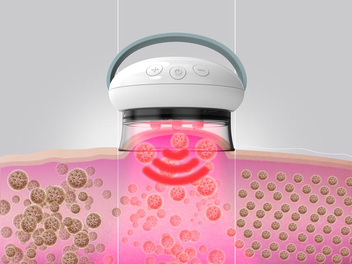 Immagine prodotto Homedics Massaggiatore IR Smoothee