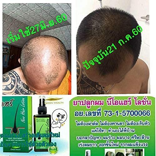 Produktbild Neo Haarwachstumsmittel (120 ml)