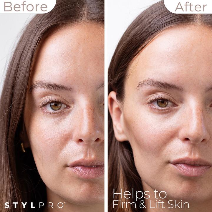 Image du produit Stylideas Mini Microcurrent Facial Toning Device