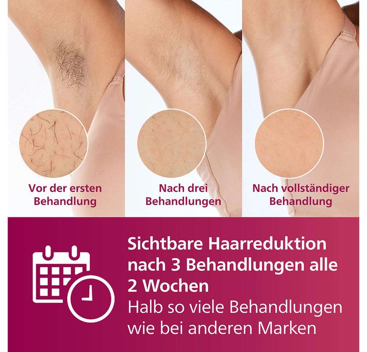 Immagine prodotto Philips Lumea IPL Series 7000