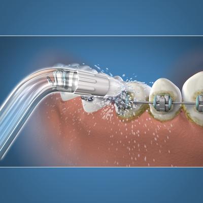 Produktbild Waterpik Orthodontic (Mundduschenaufsätze)