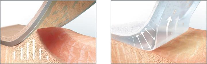 Produktbild Hansaplast Ultra Sensitive (10 x)