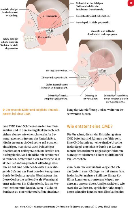 Image du produit CMD - Craniomandibuläre Dysfunktion (Allemand, Hamdi Kent, 2023)