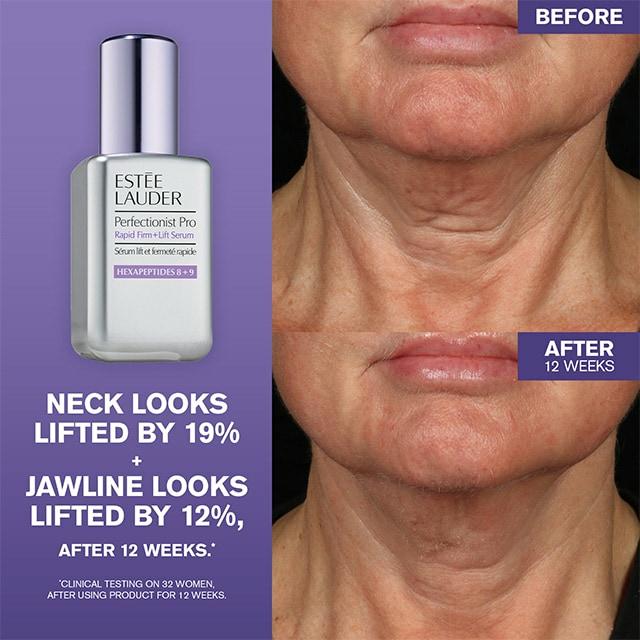 Image du produit Estée Lauder Perfectionist Pro (50 ml)