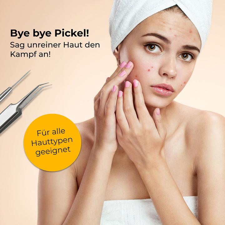 Actual product image Hermex Blackhead Remover (Blackhead remover)
