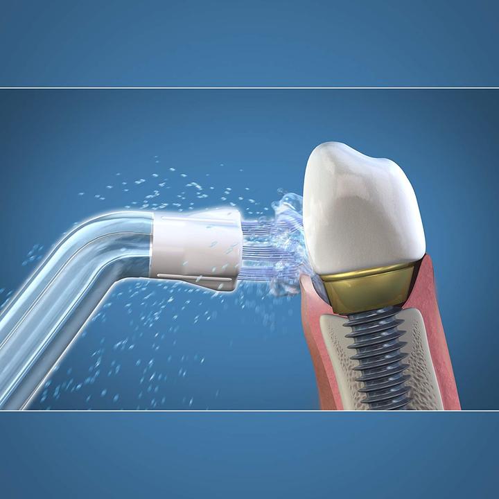 Produktbild Waterpik Whitening Water Flosser (Mundduschenaufsätze)