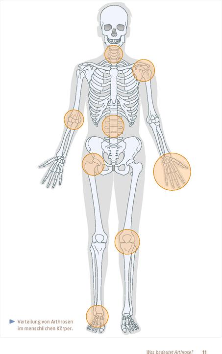 Produktbild Expertenwissen: Arthrose (Deutsch, Prof. Dr. Hanno Steckel, 2024)