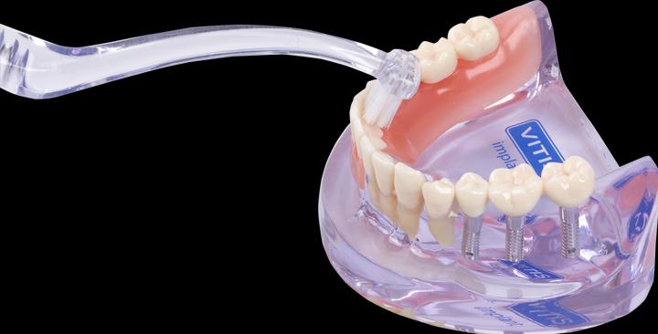Produktbild Dentaid Vitis Implant Angular (1 x)
