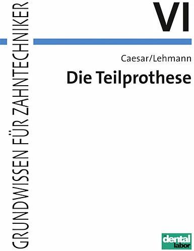 Image du produit Die Teilprothese (Allemand, Hans H. Caesar, Klaus M. Lehmann, H Hans Caesar, 2007)