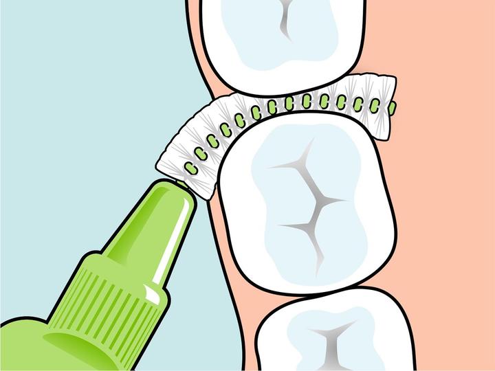 Image du produit TePe Interdentalbürsten Original Grün ISO 5 (8 x, 0.80 mm)