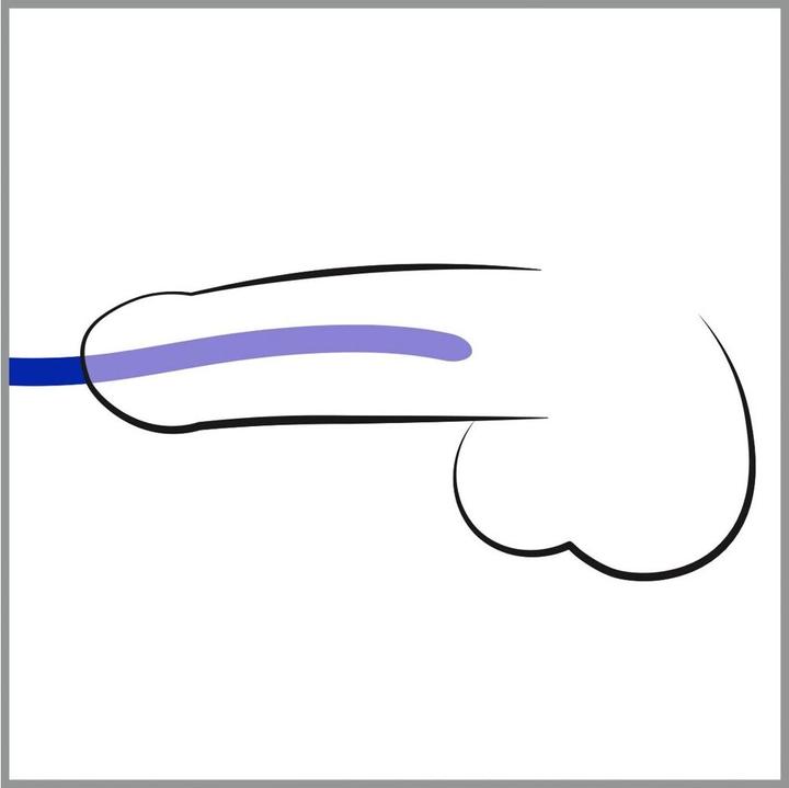 Actual product image You2Toys Dilator Set