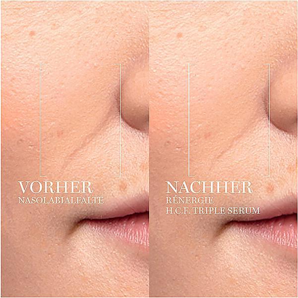 Immagine prodotto Lancôme Siero triplo Rénergie H.C.F. (20 ml)