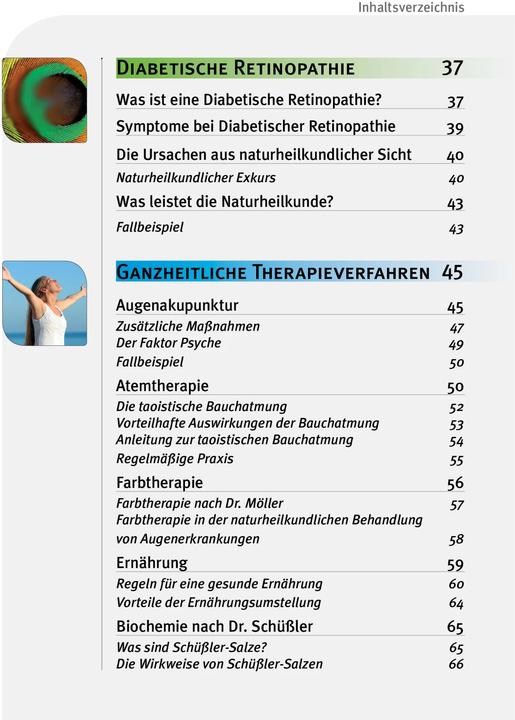Actual product image Makula-Degeneration und Diabetische Retinopathie (German, Andreas Nieswandt, 2024)
