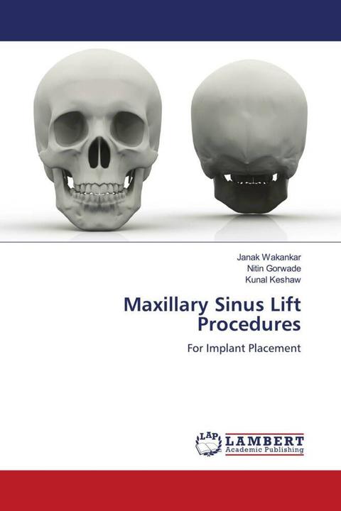 Produktbild Maxillary Sinus Lift Procedures (Kunal Keshaw, Nitin Gorwade, Janak Wakankar, 2022)