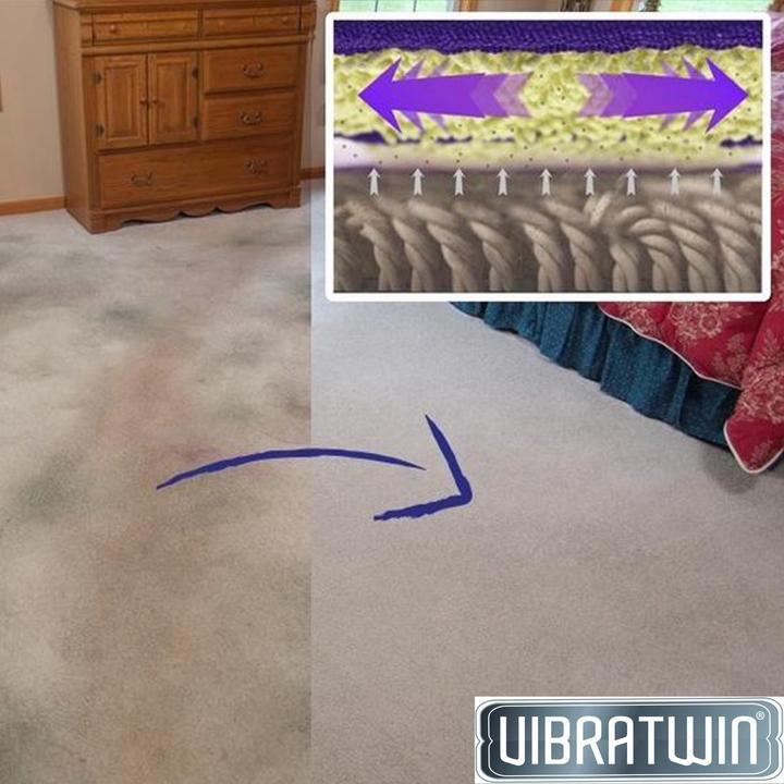 Immagine prodotto VibraTwin Ersatzpad (1 pz.)