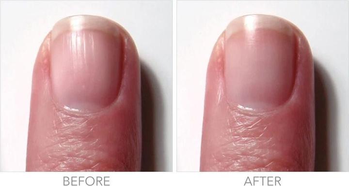 Image du produit Londontown Cure - Comblement de crête (Blanc, Vernis couleur)
