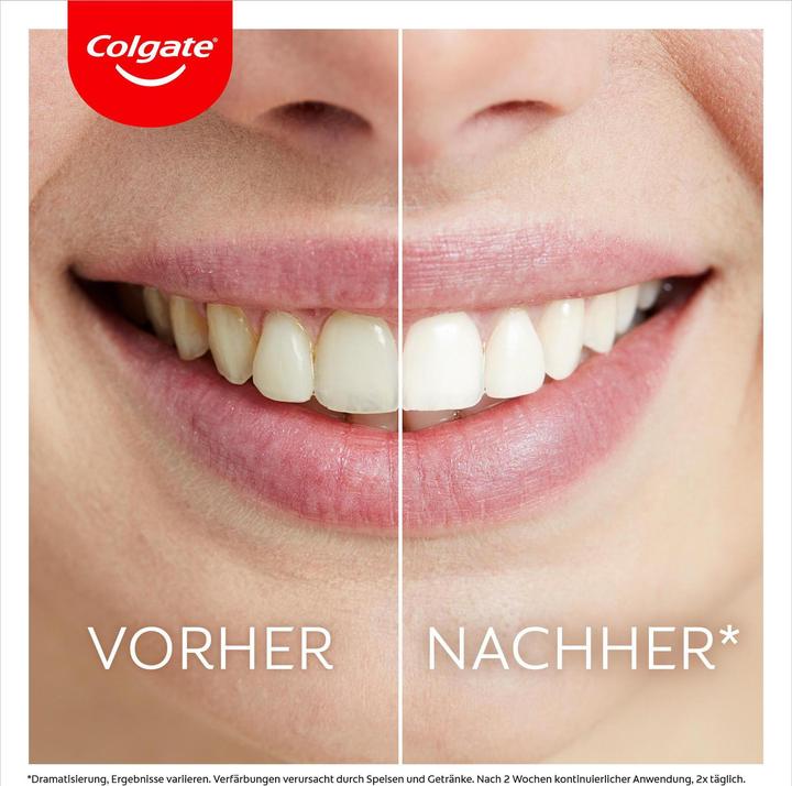 Produktbild Colgate Max White Ultim Whitening Kit (LED Licht)