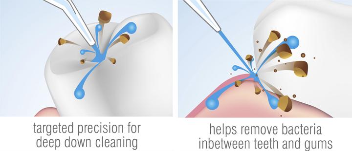 Actual product image Rio Oral irrigator DCIR2
