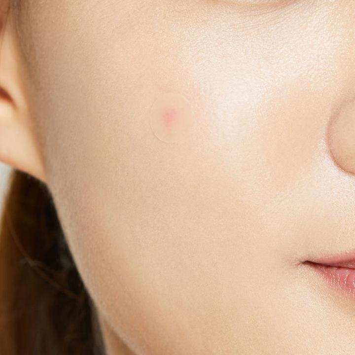 Productafbeelding Cosrx Acne Pimple Master
