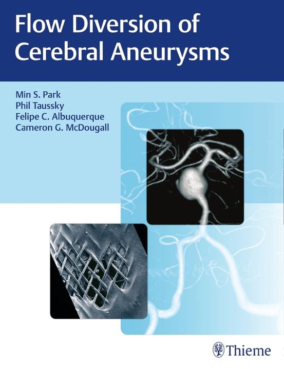 Actual product image Flow Diversion of Cerebral Aneurysms (English, Cameron G. McDougall, Felipe C. Albuquerque, Philipp Taussky, Min S. Park, 2017)