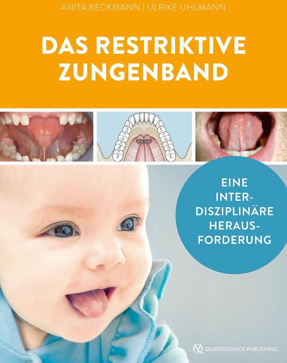 Image du produit Le frein lingual restrictif (Allemand, Anita Beckmann, Ulrike Uhlmann, 2024)