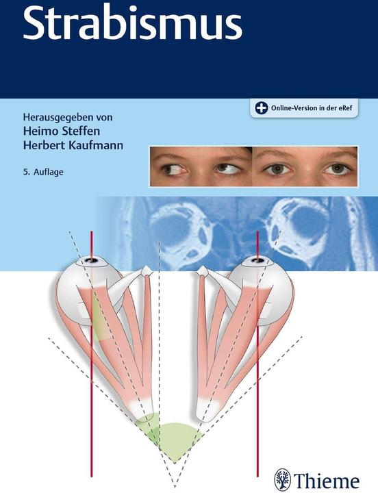 Actual product image Strabismus (German, Heimo Steffen, Herbert Kaufmann, 2020)
