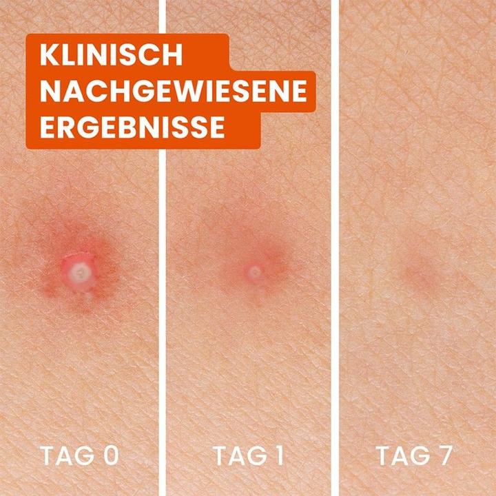 Produktbild Bioré Anti-Pickel (1 ml)