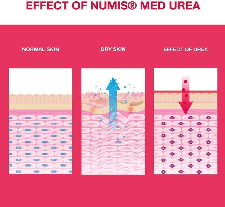 Actual product image Numis Med UREA 25% chapped skin ointment (Foot cream & foot gel, 50 ml)