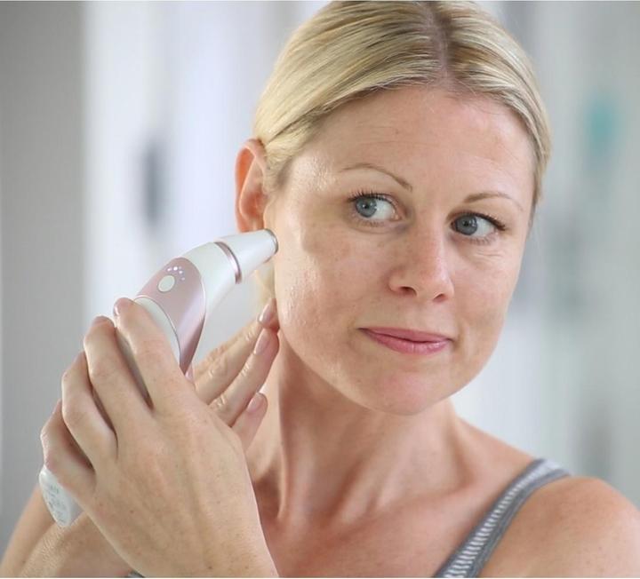 Image du produit Homedics HoMedic appareil de microdermabrasion MDA-100RG