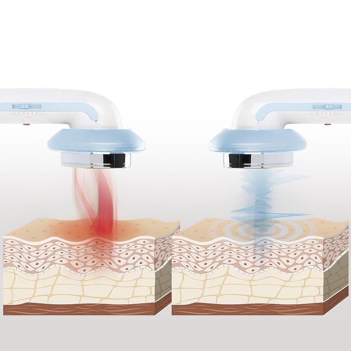 Actual product image InnovaGoods Massage device with ultrasonic cavitation