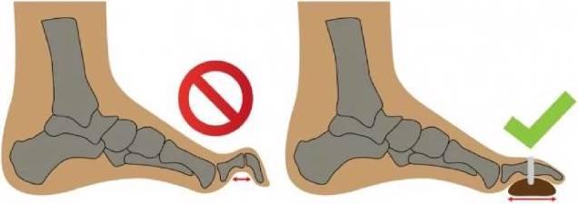 Produktbild Bota Podo 26 Rechts L (L)