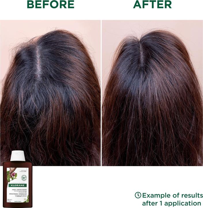 Immagine prodotto Klorane Rafforzamento con chinino e stella alpina biologica (200 ml, Shampoo liquido)