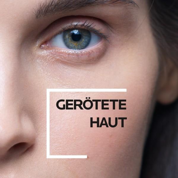 Produktbild La Roche Posay Toleriane Rosaliac AR Konzentrat (40 ml, 24h Creme)