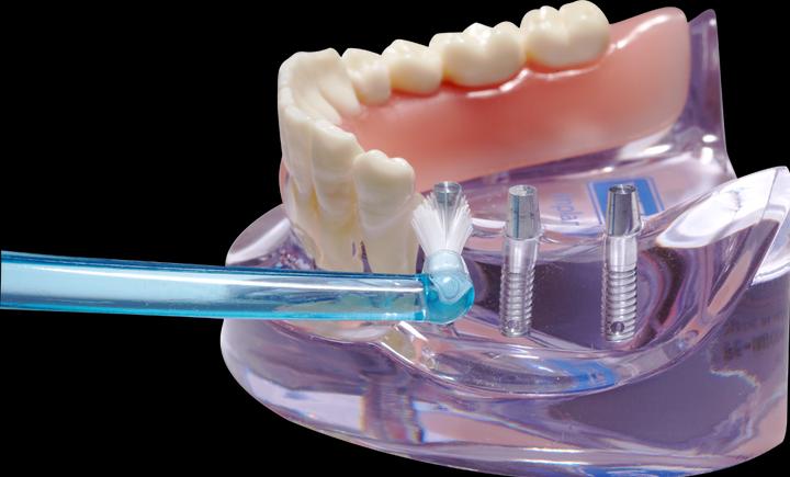 Produktbild Dentaid Vitis Implant Monotip Zb (1 x)