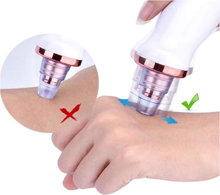 Produktbild Zoë Ayla Blackhead Extractor